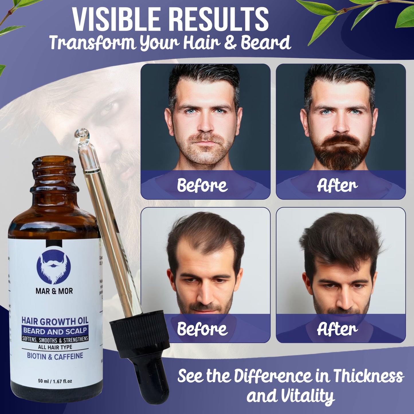 Mar&Mor - Hair Growth Oil - Biotin & Caffeine - 100% Natural - Jojoba Oil & Castor Oil & Rosemary Oil | UNIQUE Canadian Hair Care |